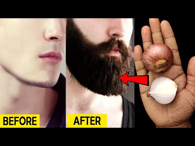 Featured image of post How To Grow Beard Quickly At Home